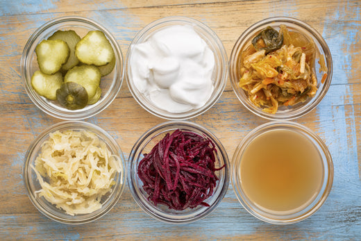 Verschiedene fermentierte Lebensmittel, die die Darmgesundheit fördern.